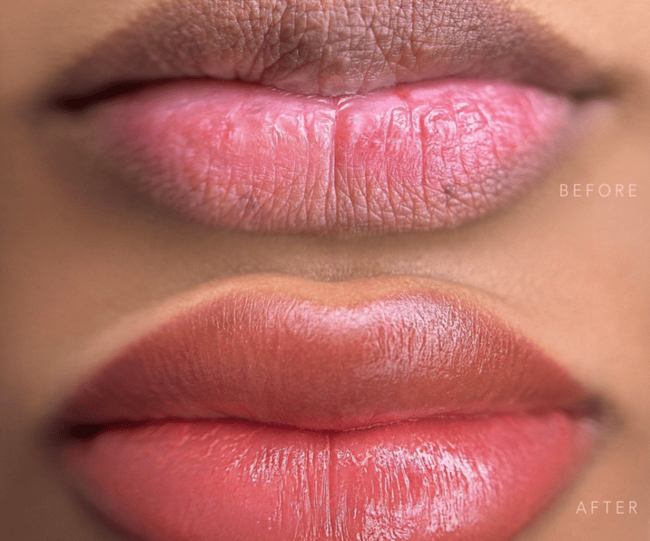 Dark Lip Treatment - Pink, Soft & Even-Toned Lips